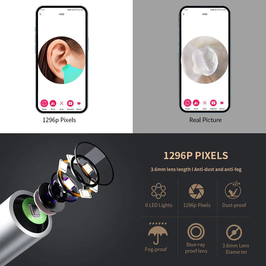 Smart Visual Ear Cleaner with Camera: The Ultimate Ear Wax Removal Tool