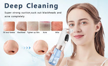 BXA Blackhead Remover Pore Vacuum – Deep Facial Cleansing with Hydration Technology - Natural Glow