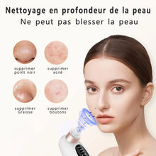 BXA Blackhead Remover Pore Vacuum – Deep Facial Cleansing with Hydration Technology - Natural Glow