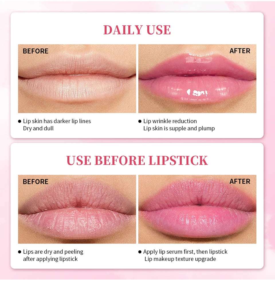 Natural GlowNatural Pink Serum Lips Pink Fresh Remove Dark Lips Gel Lightening Essence Cream Balm Repair Fine Line Brighten Lip Exfoliator