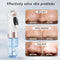 BXA Blackhead Remover Pore Vacuum – Deep Facial Cleansing with Hydration Technology - Natural Glow