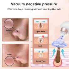BXA Blackhead Remover Pore Vacuum – Deep Facial Cleansing with Hydration Technology - Natural Glow